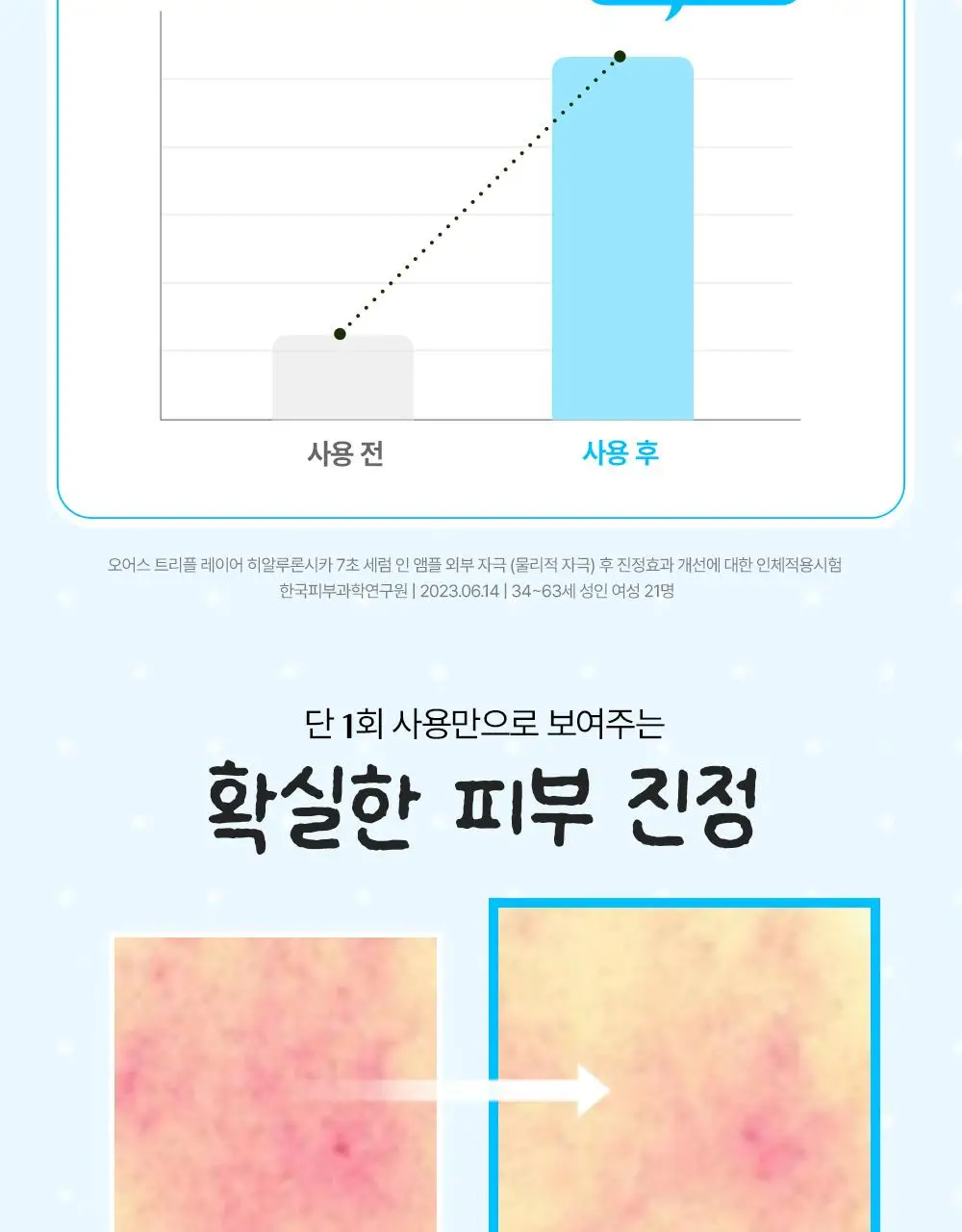 [부루부루도그 콜라보] 오어스 히알루론시카 7초 세럼 인 앰플 105ml 기획 (+애착베개키링,치크팩2p) 상세페이지 17